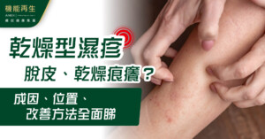 乾燥型濕疹脫皮、乾燥痕癢？成因、位置、改善方法全面睇